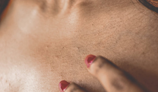 Was hilft gegen Pickelmale? 5 Tipps für eine ebenmäßige Haut